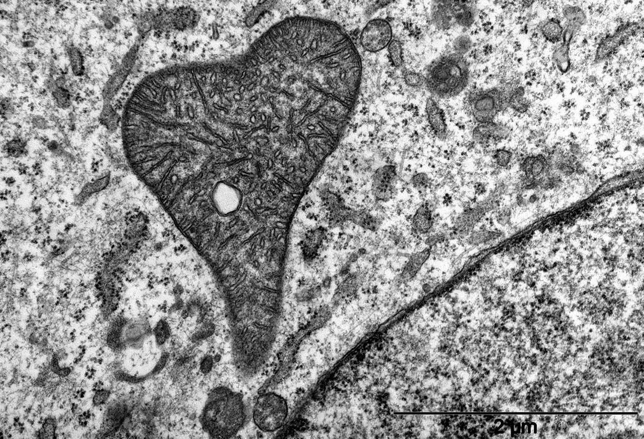<hr>Mitochondrie dans une cellule LS174. © N. Mazure, IRCAN, Nice.