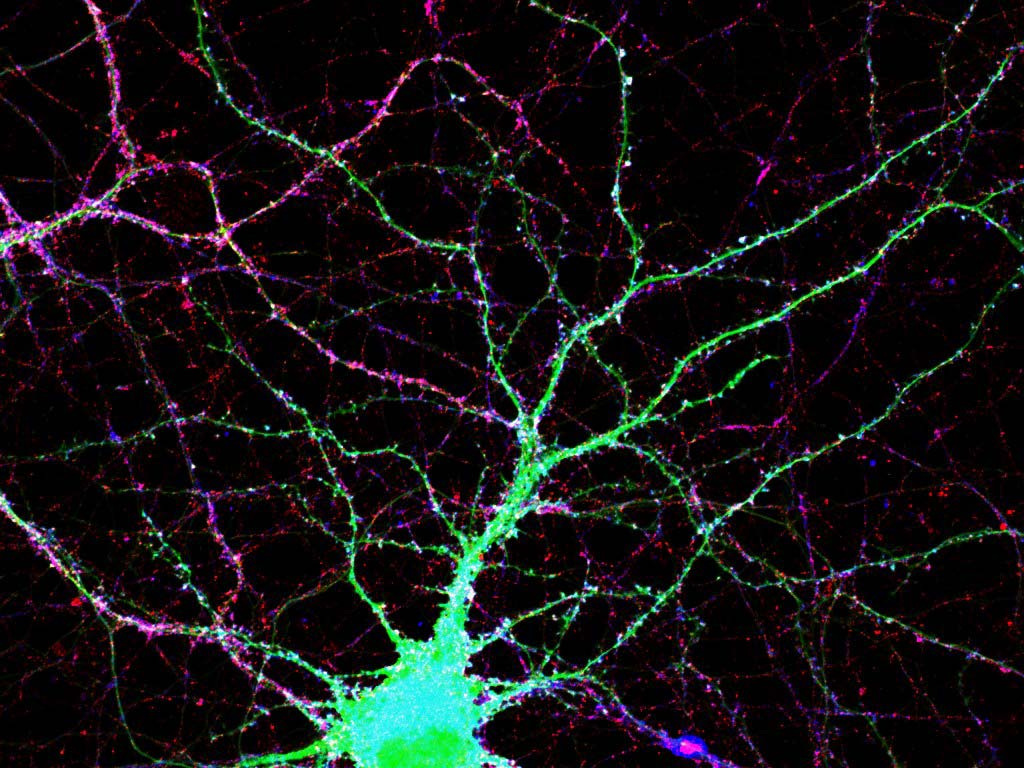<hr>Neurones d’hippocampe murins avec GluA1 en surface (en bleu) et GluA1 cytosolique (en rouge). © A. Folci, IPMC, Valbonne.