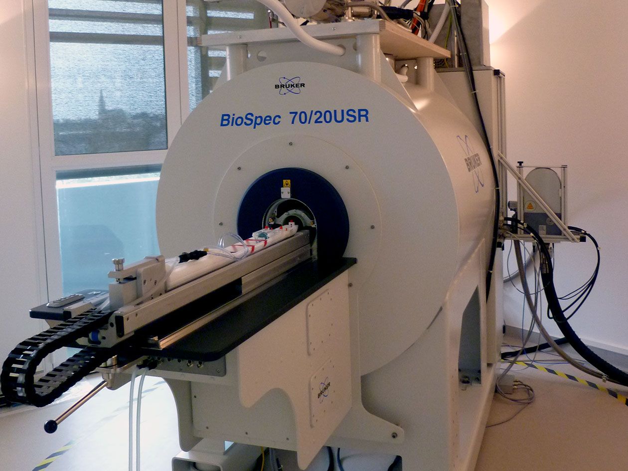 <hr>IRM 7T. © Université d’Angers.