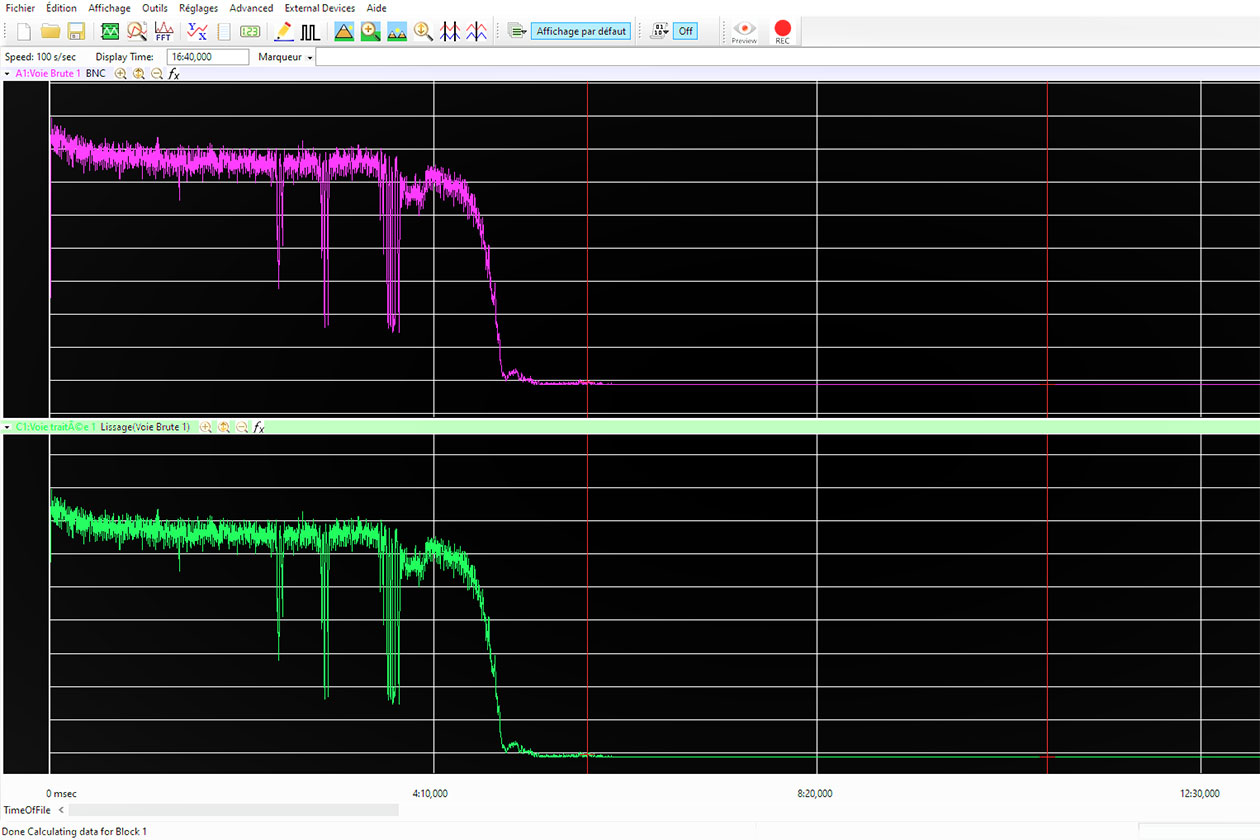<hr>Courbe d’un laser Doppler montrant une occlusion artérielle.