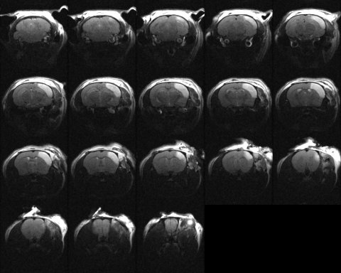 <hr>Image de la séquence T2 par IRM 7T pour la visualisation de lésions.