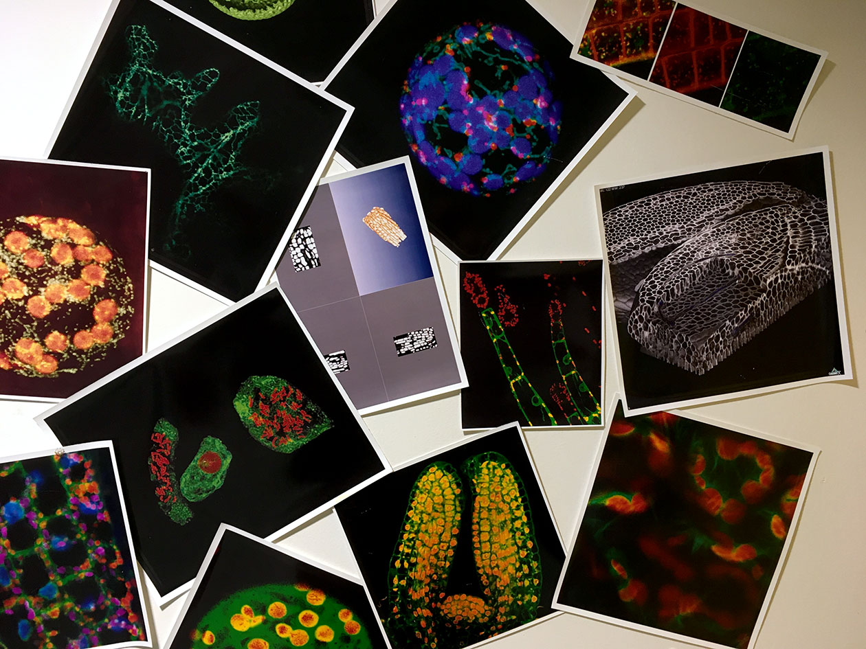 <hr>Exemples d’analyses en imagerie et histologie.