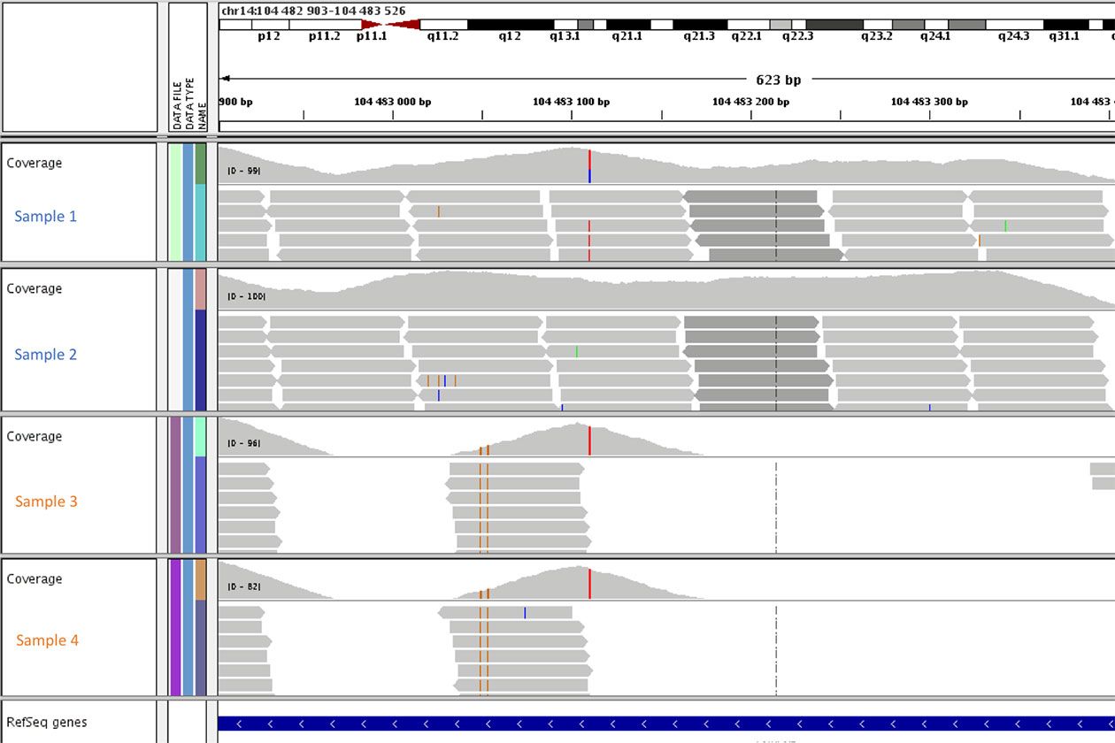 <hr>Visualisation dans un navigateur de génome de données de reséquençage d’exomes dans une région délétée pour deux patients (échantillons 3 et 4).