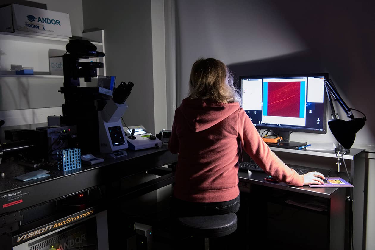 <hr>Microscope confocal spinning disk (Andor).