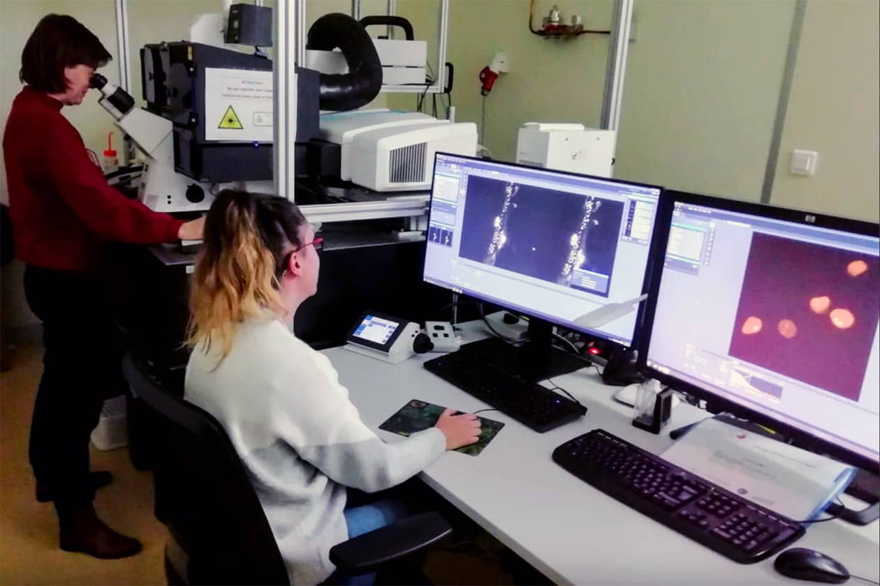 <hr>Microscope LSM880 Airyscan (Zeiss).