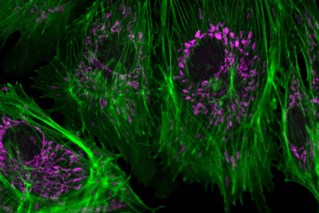 <hr>Observation au microscope confocal Zeiss LSM880 de fibroblastes avec mitochondries en magenta et actine filamenteuse en vert.