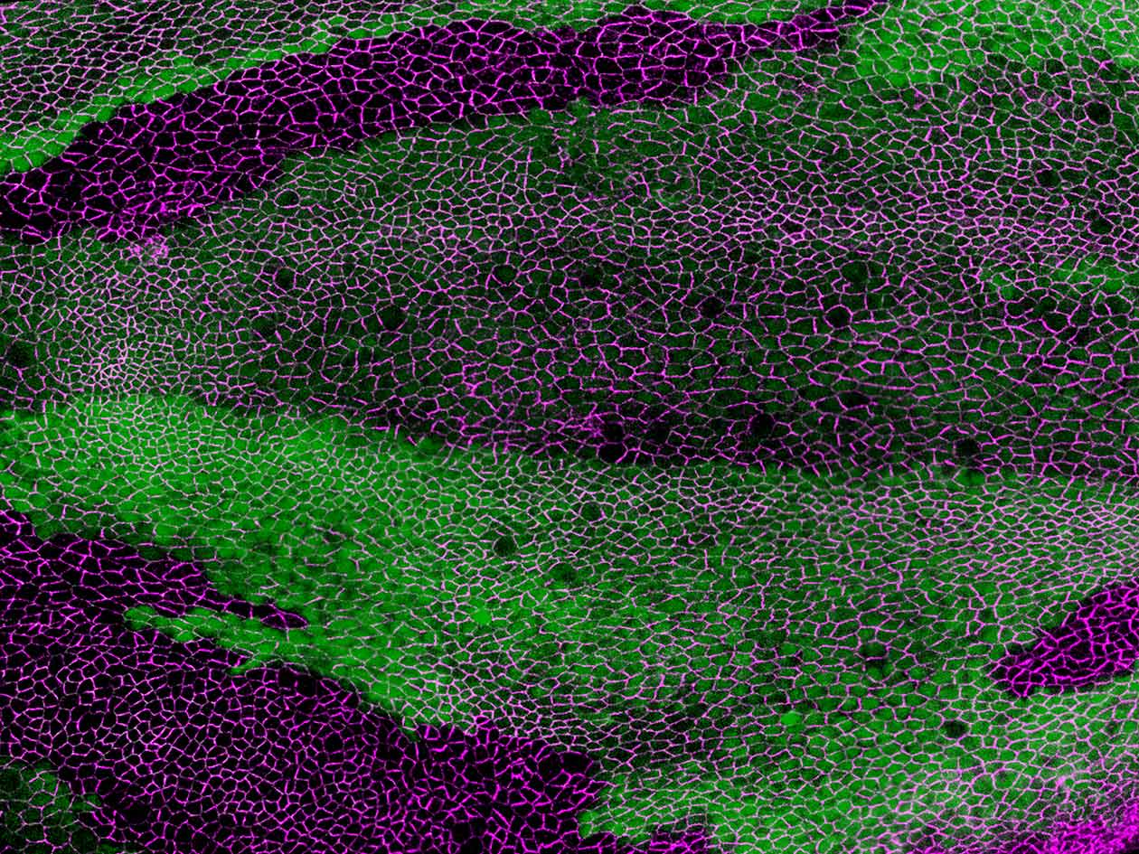 <hr>Aile de drosophile durant la métamorphose. Microscopie confocale à fluorescence © P.L. Bardet, équipe Bellaïche.