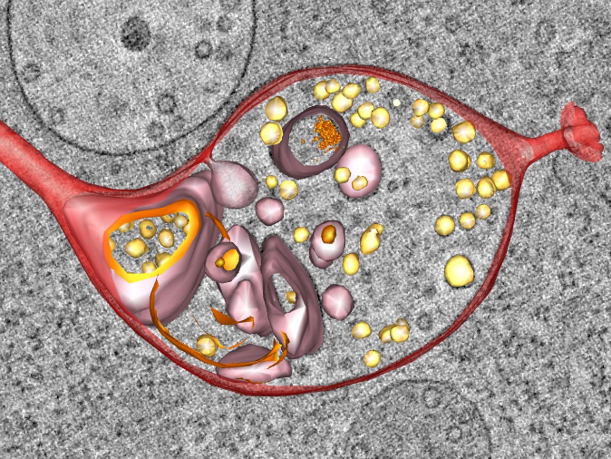 <hr>Reconstruction et segmentation d’un endo-lysosome dans une cellule HeLa. Tomographie. © I. Hurbain, équipe Raposo.