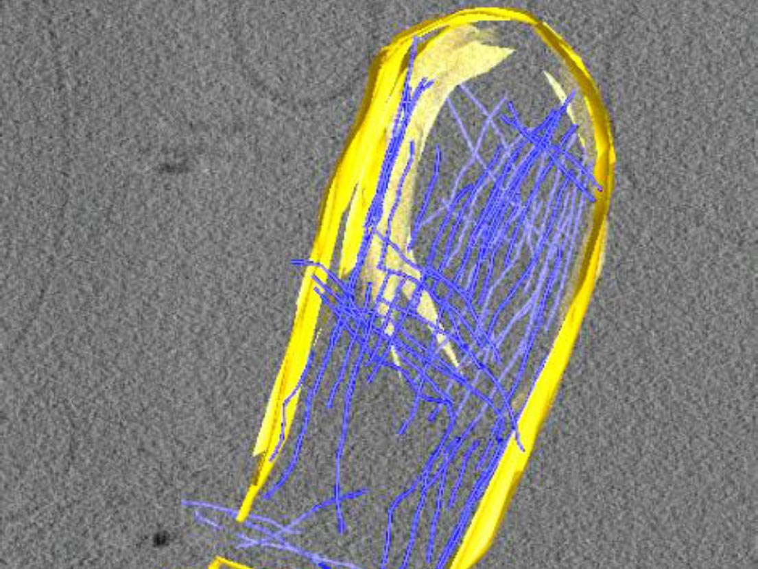 <hr>Reconstruction 3D et segmentation de filament de septines (en bleu) sur du PIP2 (en jaune). Cryo-tomographie. © A. Bertin, équipe Lévy.