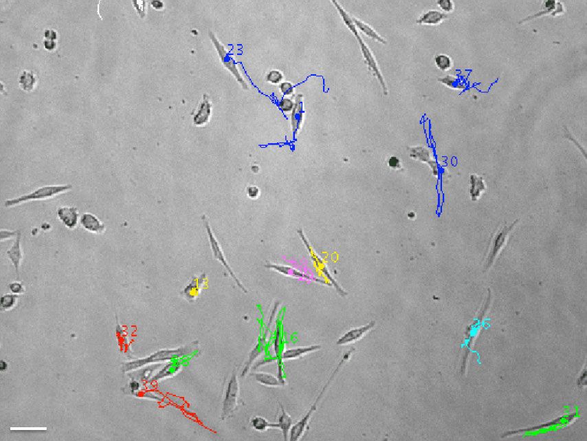 <hr>Migration de cellules humaines de mélanomes métastatiques. Microscopie en lumière blanche © D. Lécuyer, U3347-U1021.