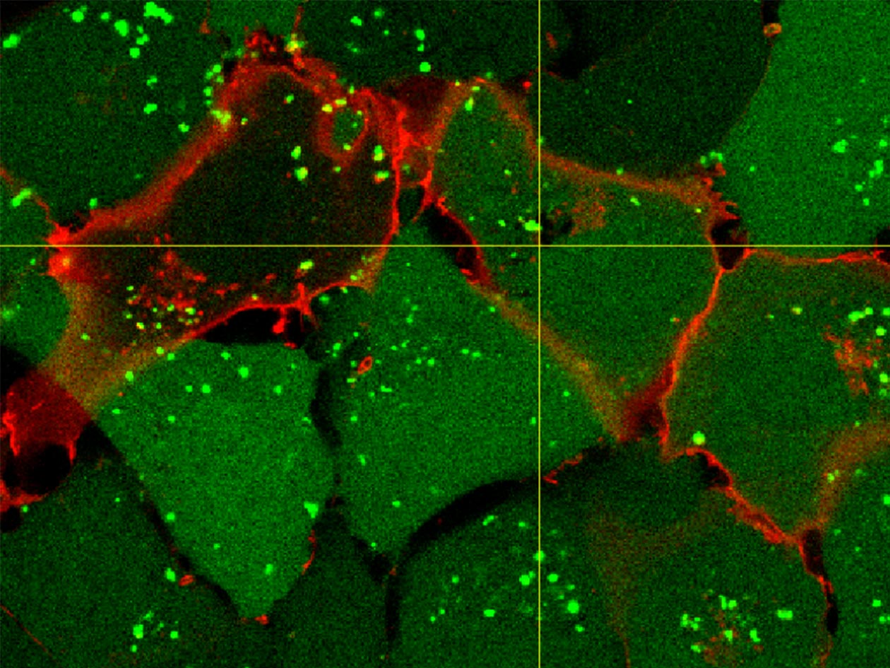 <hr>Internalisation de peptide dans des cellules. Microscopie confocale à fluorescence © L. Méry, U3347-U1021.