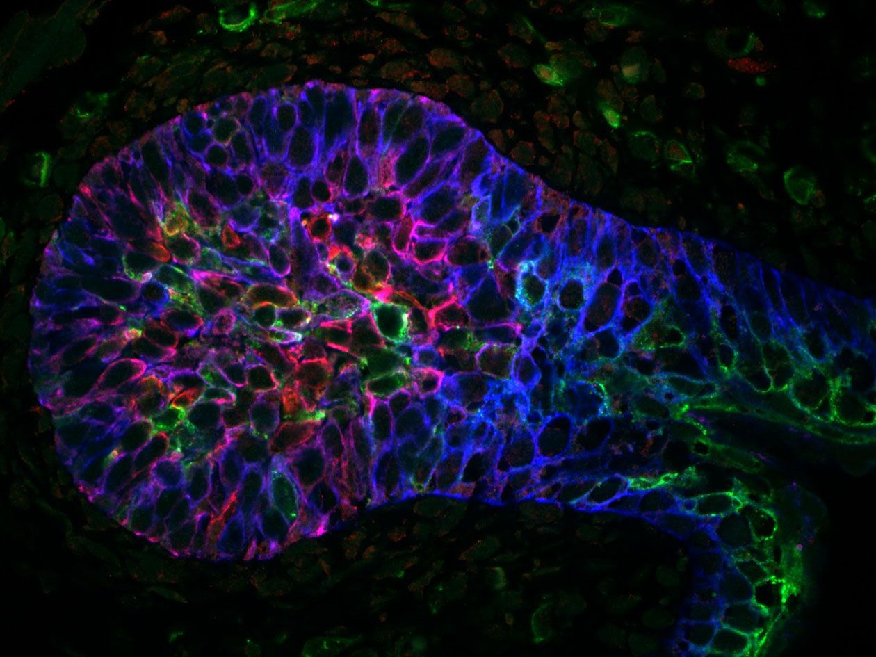 <hr>Glande mammaire de souris. Microscopie confocale à fluorescence © R. Veronica, équipe Fre.