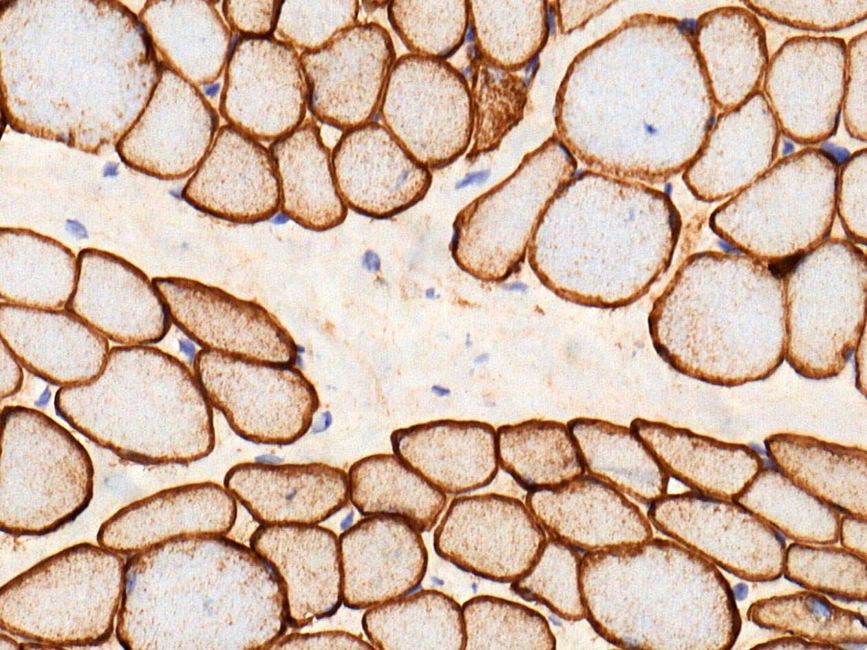 <hr>IHC Cavéolin (Agilent Omnis). 3DHisTech Pannoramic 250.