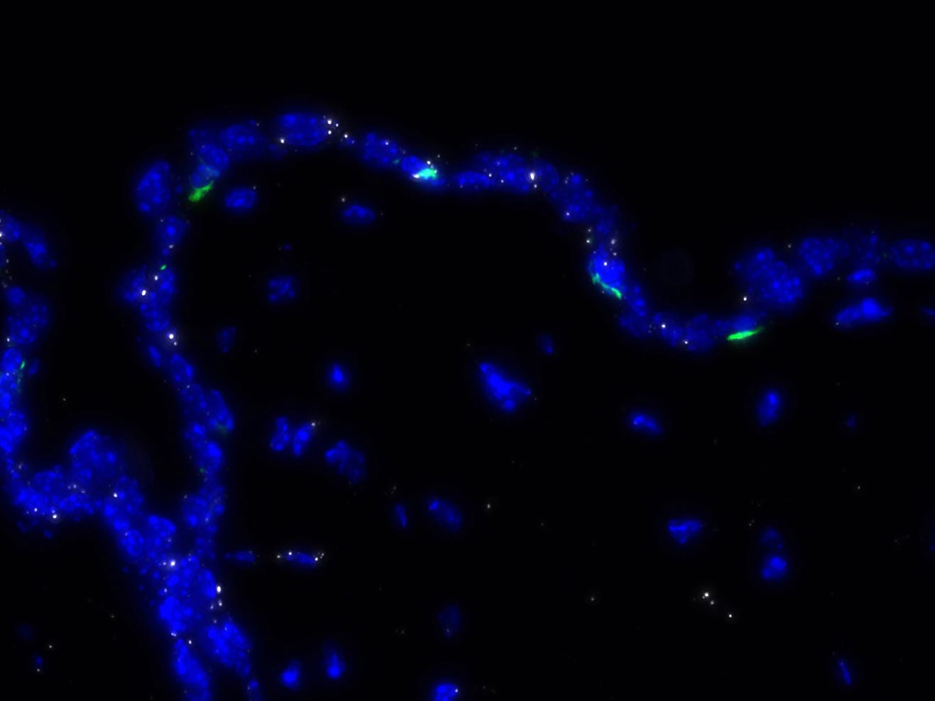 <hr>Immunofluorescence (Roche/Ventana Discovery). CD207 (vert) et RNAScope PPIB (blanc). 3DHisTech Pannoramic 250.