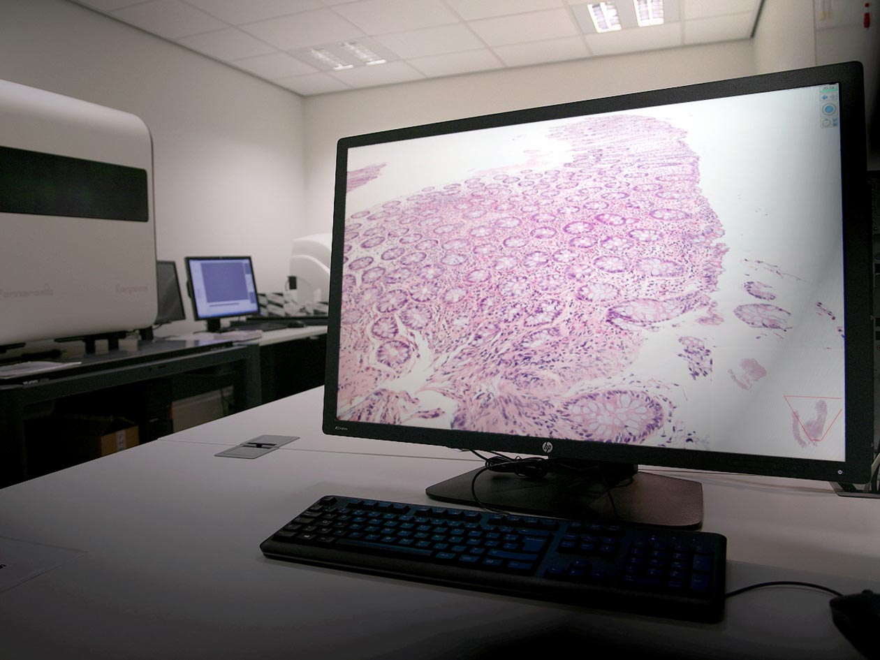 <hr>Pièce d’acquisition et d’analyse d’images de la plateforme.