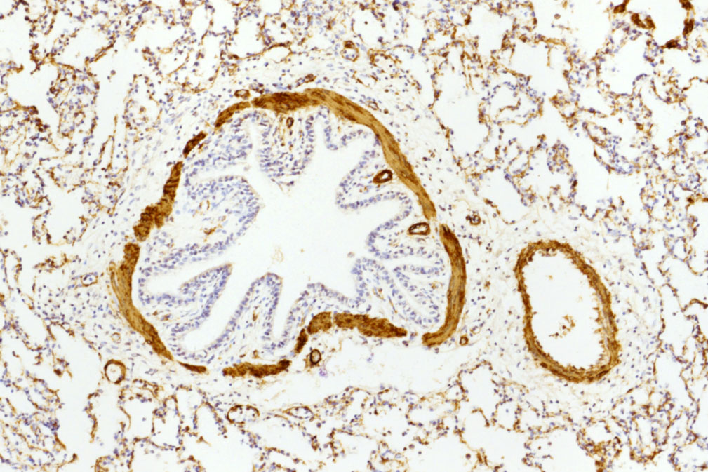 <hr>Bronchiole et artère pulmonaire de porc (actin, x 100).