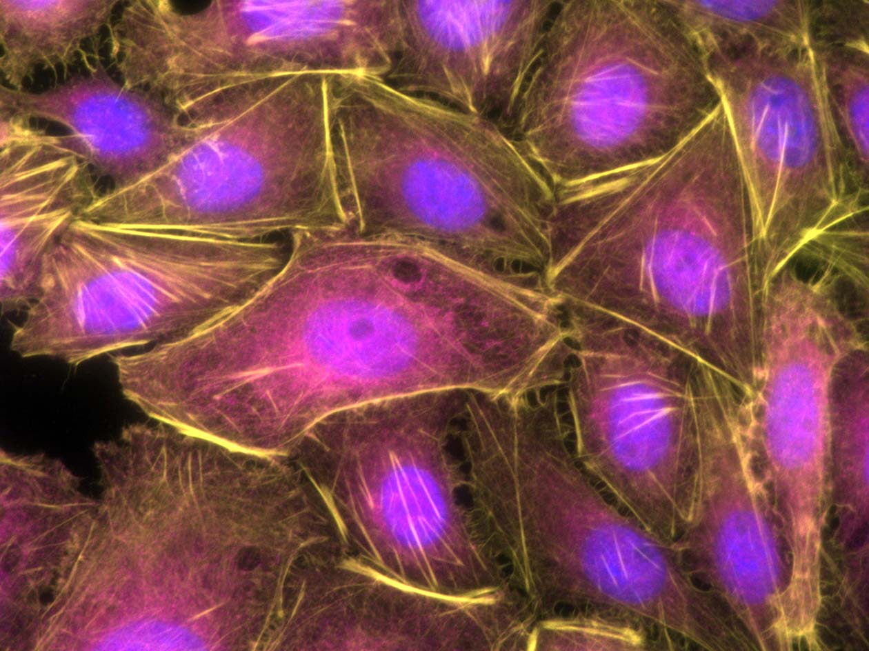 <hr>Immunomarquage en fluorescence montrant l’actine en vert, HSP27 en rouge, l’a-actine en rose et le noyau de fibroblastes en bleu.