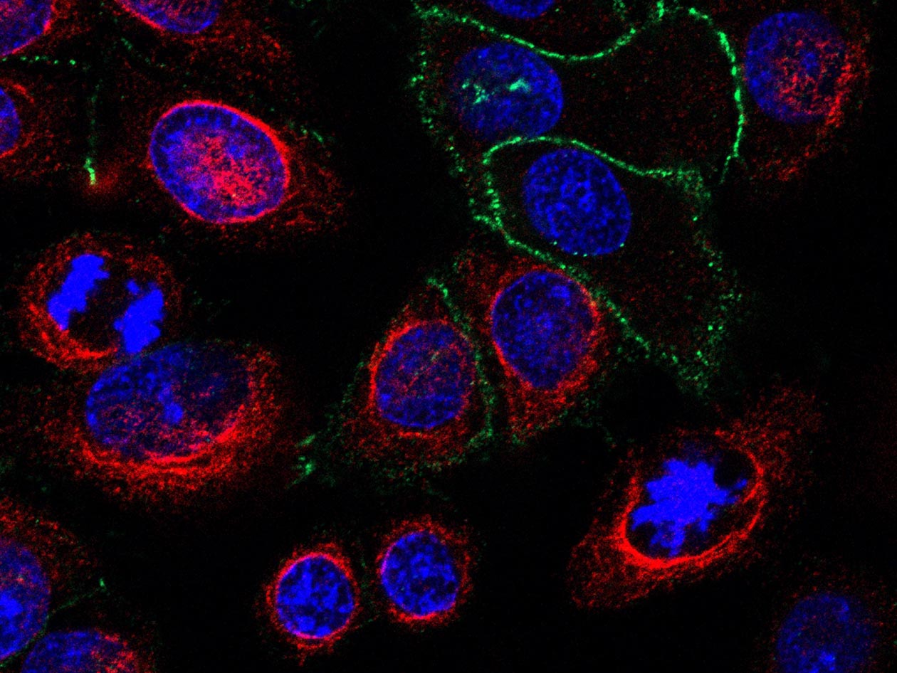 <hr>Marquage de cellules A549 avec des anticorps anti-vimentin, anti-rabbit-Alexa 488, anti-E-cadherin et anti-mouse-Alexa 555, et DAPI.