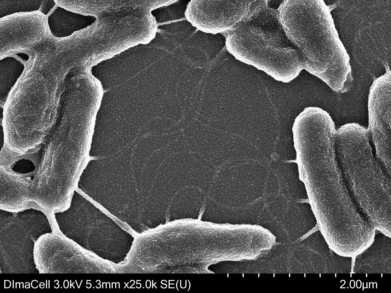<hr>Bactéries du sol Chelatobacter heinzi observées en MET.