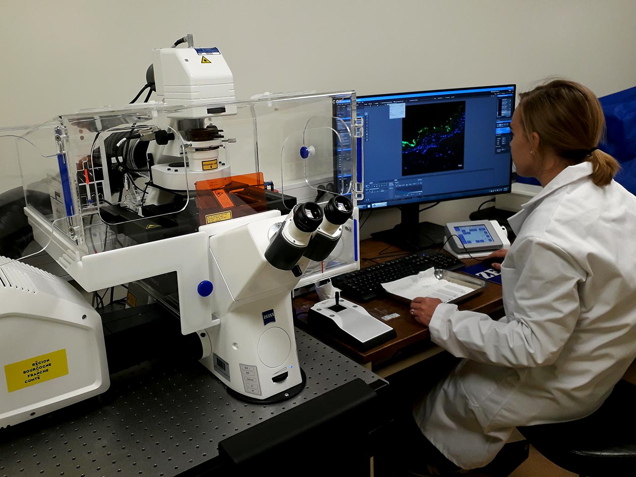 <hr>Microscope confocal Zeiss LSM800 avec Airyscan.