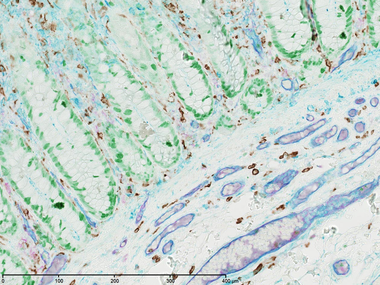 <hr>Marquage de 4 protéines d'intérêt avec des marqueurs chromogéniques pour visualiser la structure d'un tissu.