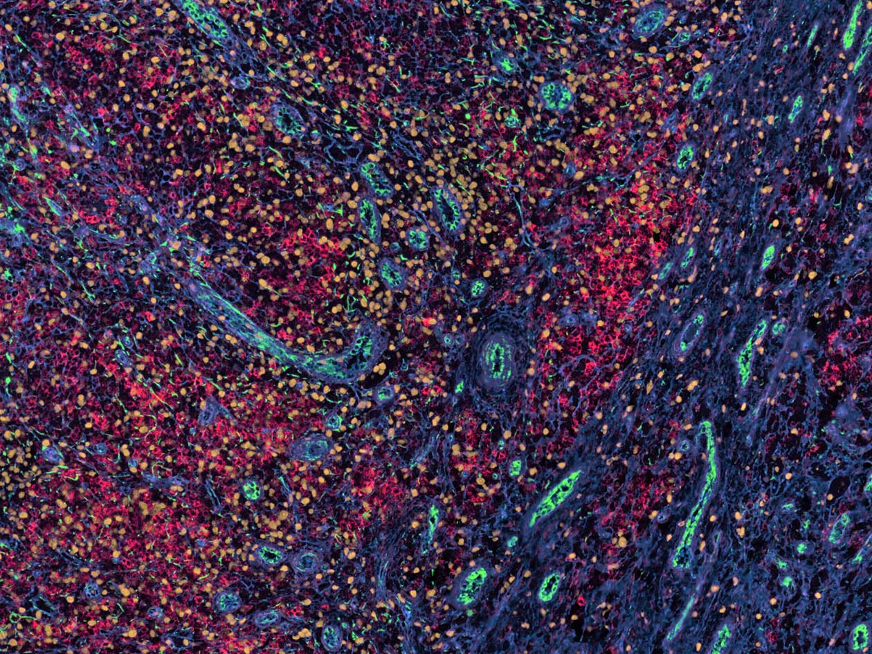 <hr>Marquage multiplex par immunofluorescence.