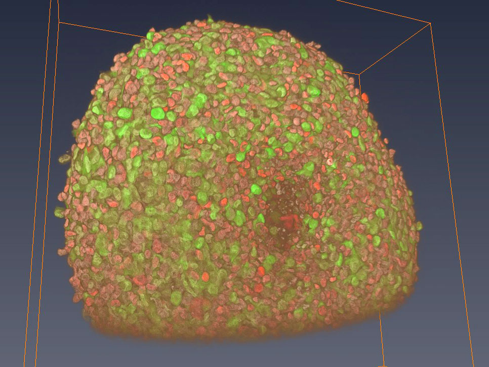 <hr>Reconstruction 3D d’un sphéroïde après transparisation et immunomarquages avec 3 fluorochromes.