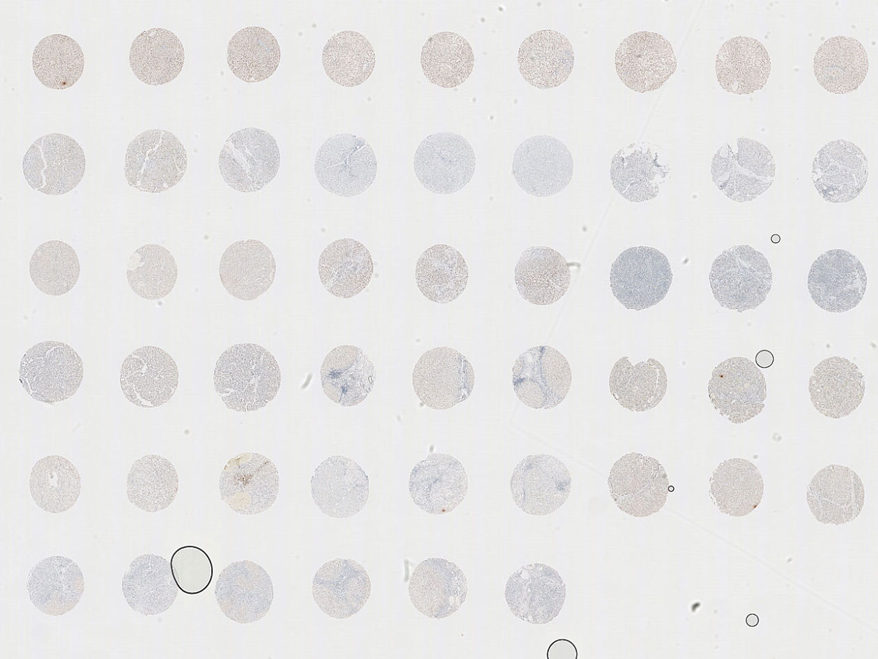 <hr>Coupe d’un bloc de TMA après marquage immunohistochimique.
