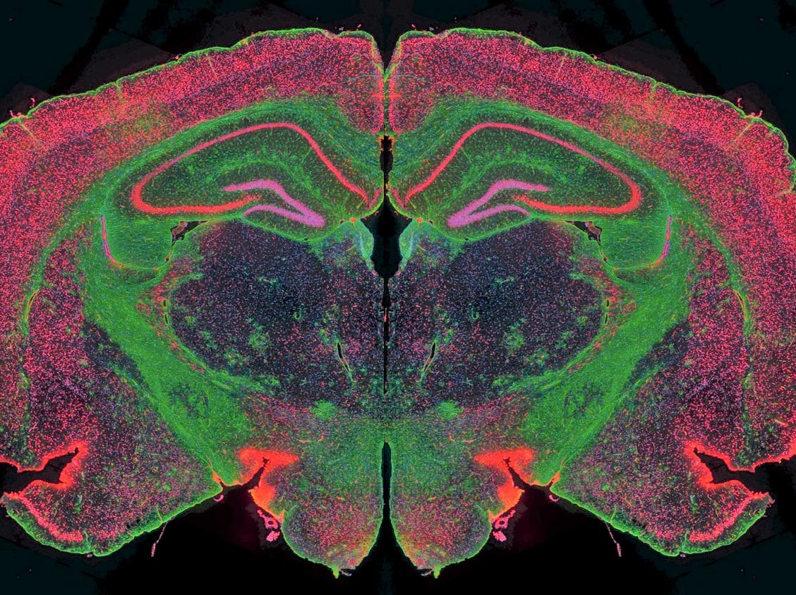<hr>Marquage multiplex d’une coupe de cerveau de souris.