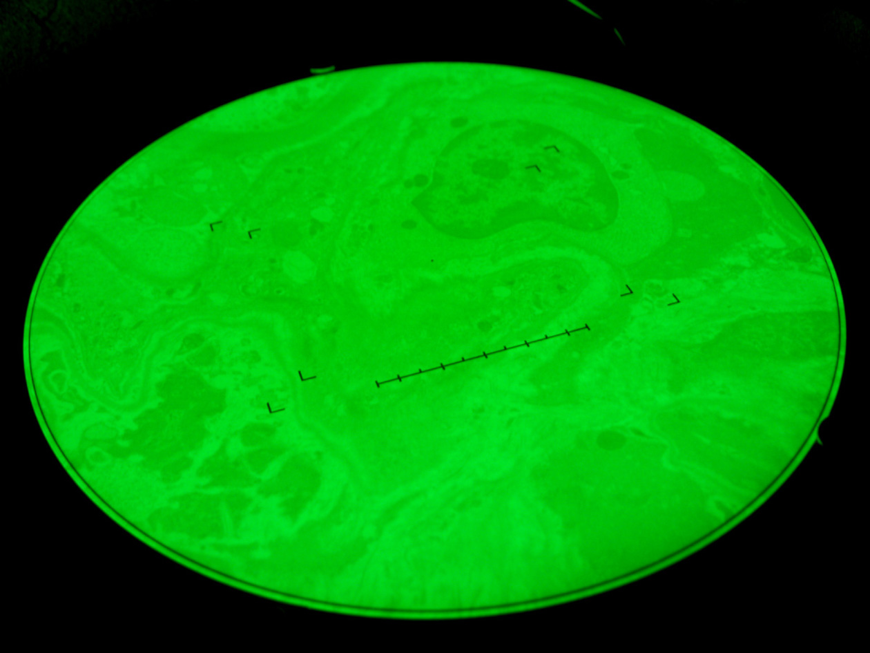 <hr>Ecran phosphorescent de MET lors de l'observation d'une coupe.