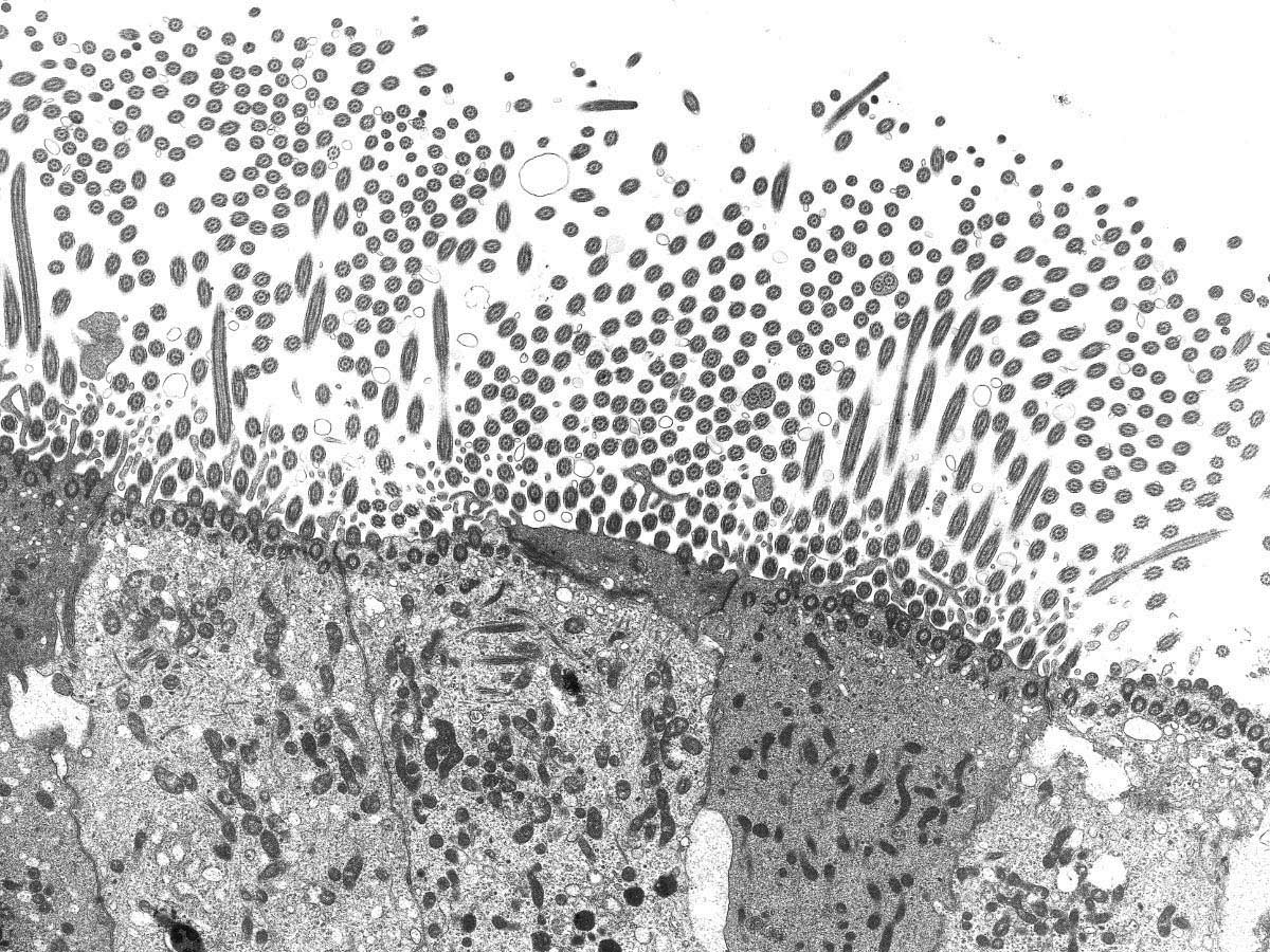 <hr>Cils de l’épithélium respiratoire observés en MET dans une coupe ultrafine.