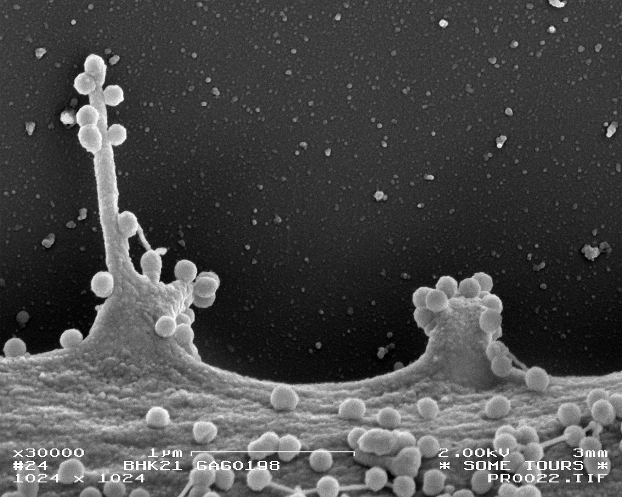 <hr>Visualisation au MEB du bourgeonnement de particules virales du VIH à la surface d’une cellule.