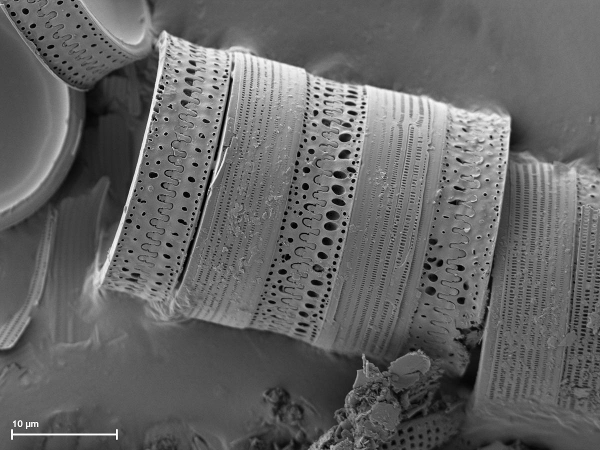 <hr>Squelettes minéraux de microalgues issues d’un prélèvement d’eau de mer observés au MEB.