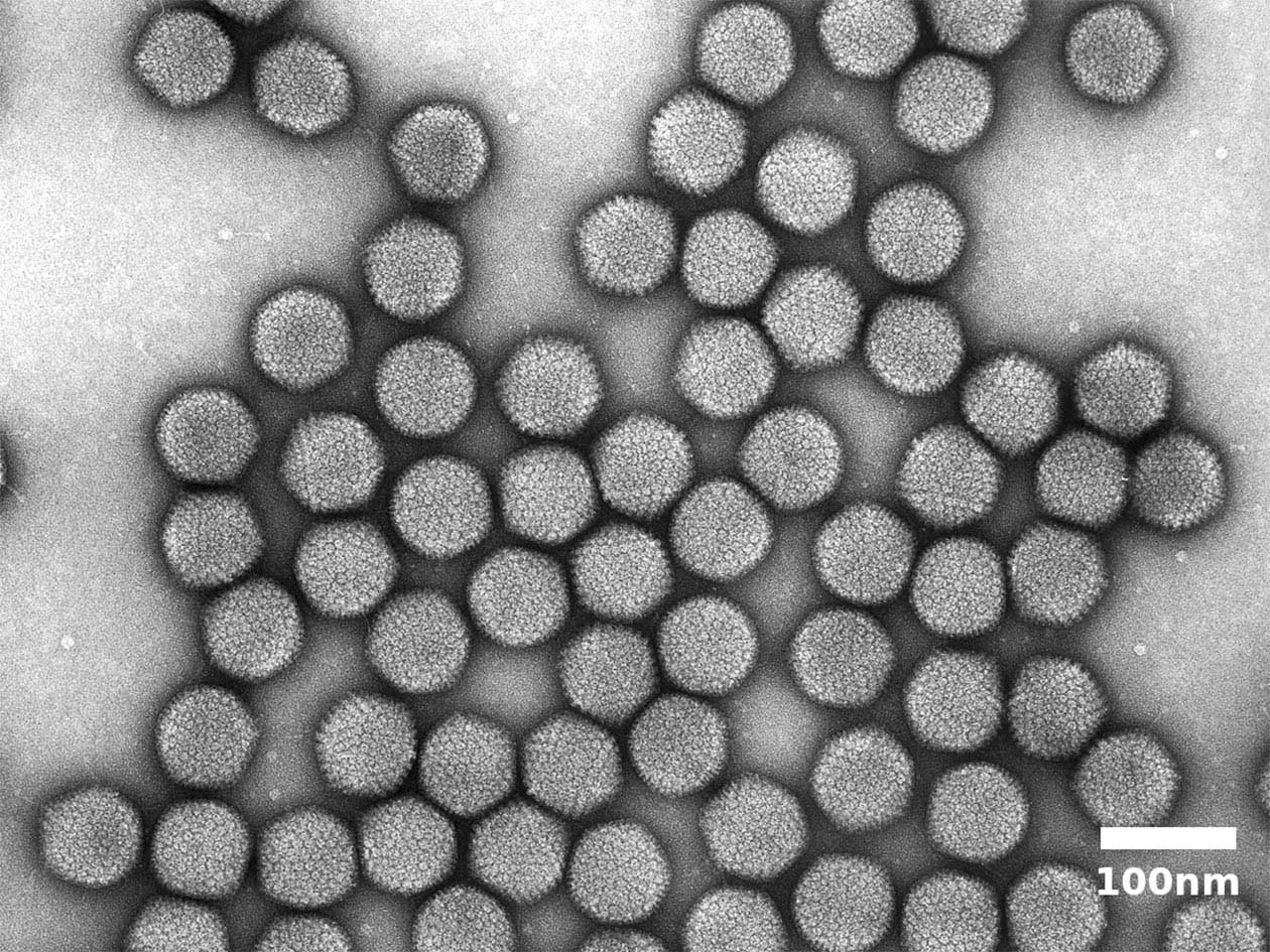<hr>Adénovirus observés au MET en coloration négative.
