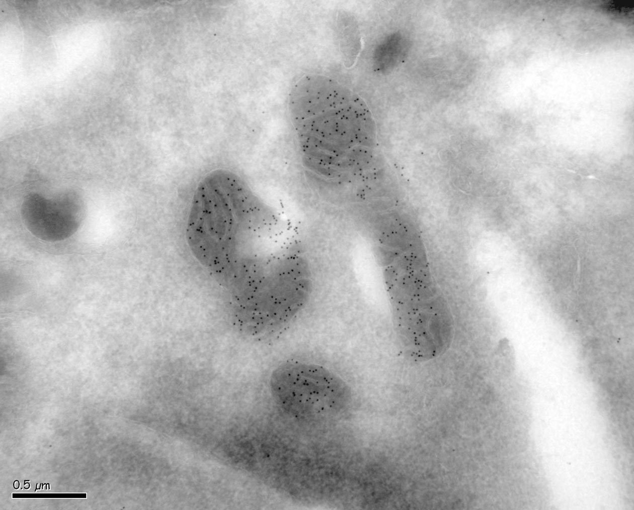 <hr>Immunomarquage à l’or colloïdal (immunogold) en MET sur cryo-coupes (méthode selon Tokuyasu).