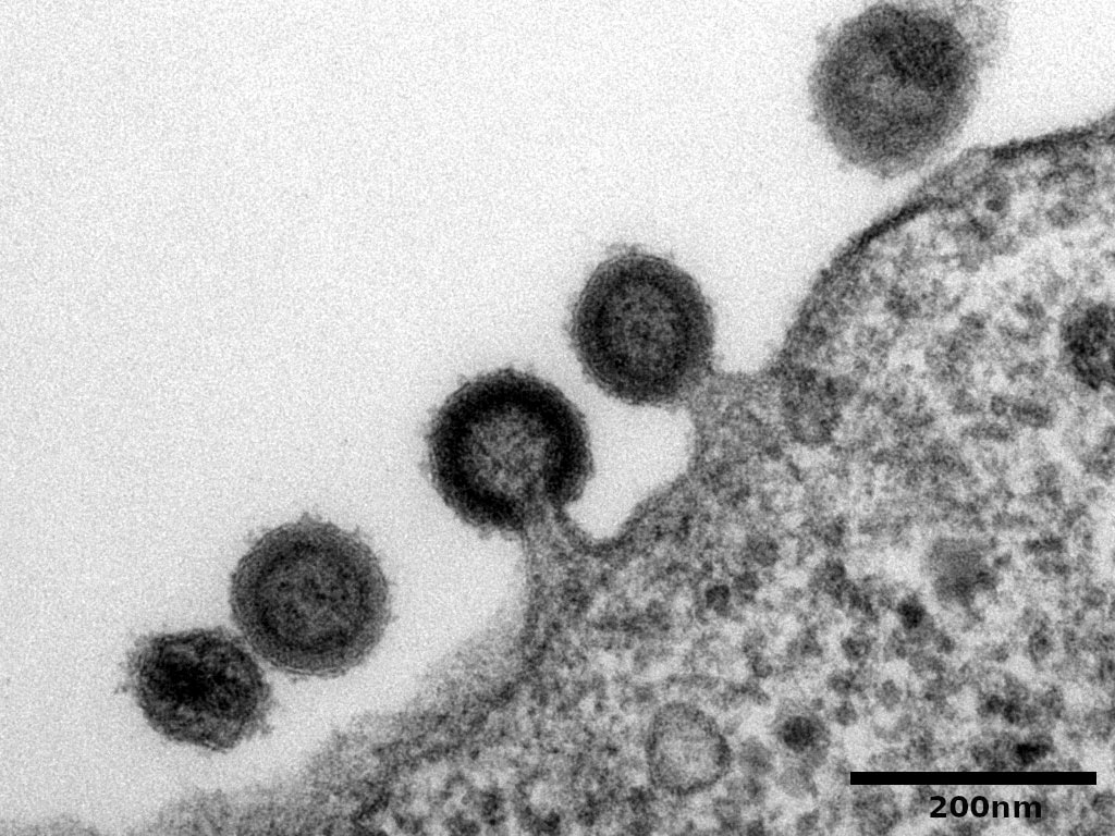 <hr>Visualisation au MET du bourgeonnement de particules virales du VIH à la surface d’une cellule (coupes ultrafines).