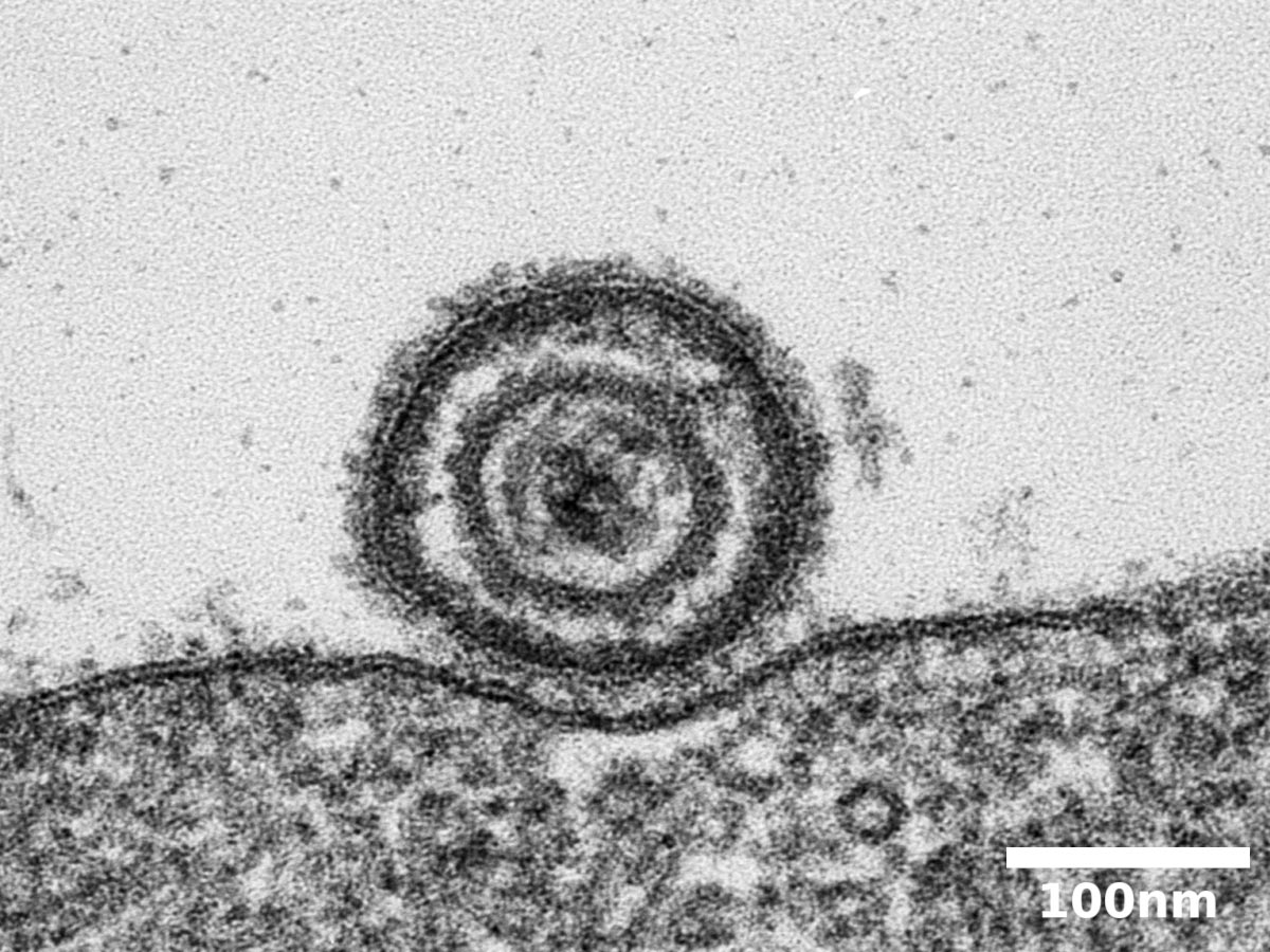 <hr>Virus de la varicelle observé au MET dans une section ultrafine.