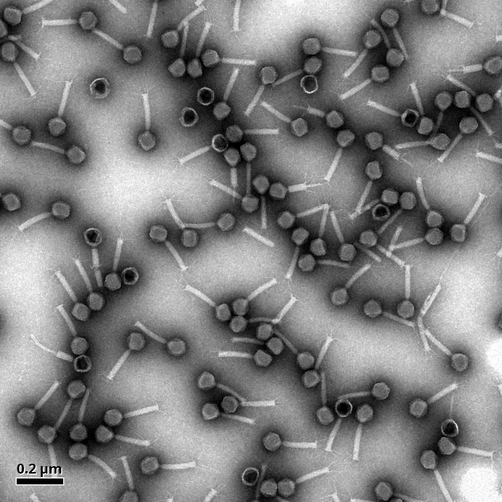 <hr>Population de bactériophages observée au MET (coloration négative à l’acétate d’uranyle).