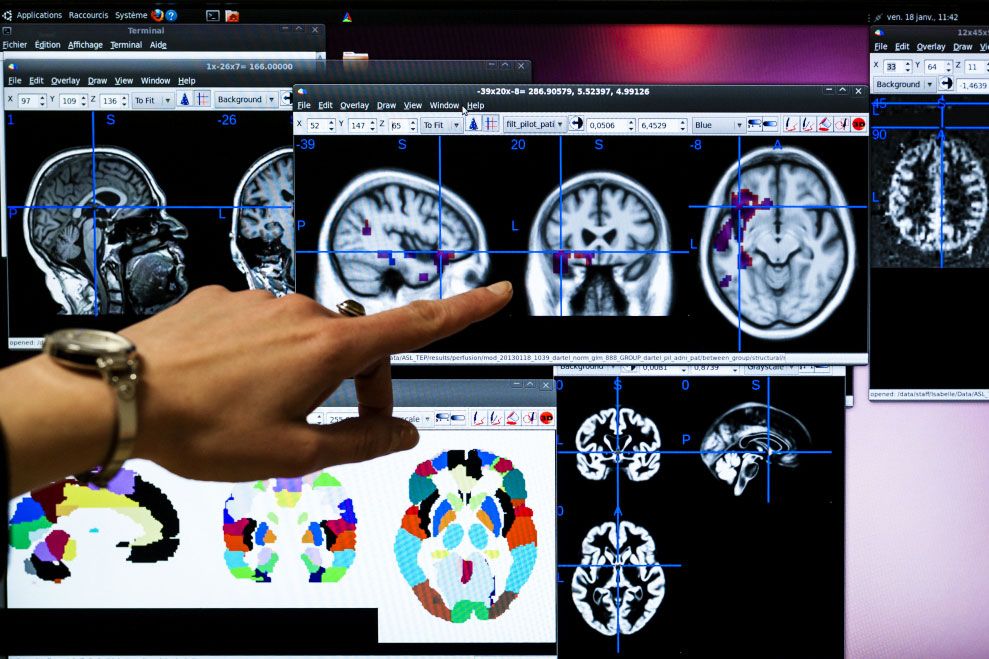 <hr>Traitement d'images cérébrales. © Inserm, P. Latron.