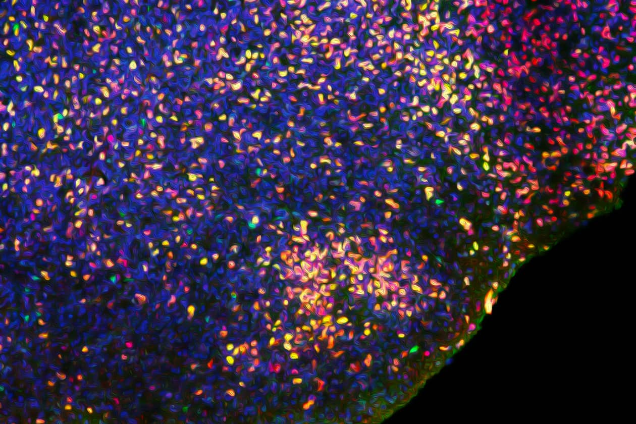 <hr>Marquage par immunofluorescence d'un organoïde cérébral stylisé sous Photoshop.