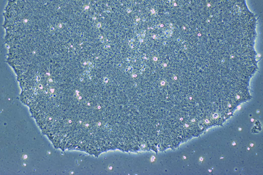 <hr>Colonie d'iPSC humaines en contraste de phase.