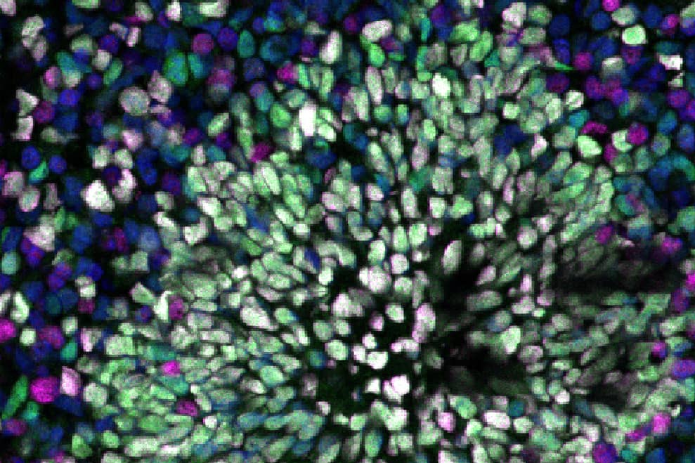 <hr>Rosette neuronale au sein d'un organoïde cérébral.