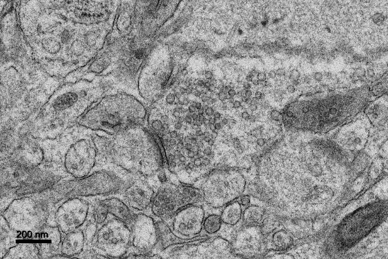 <hr>Sections de cerveau de souris inclus en résine Epon après cryo-fixation sous haute pression.