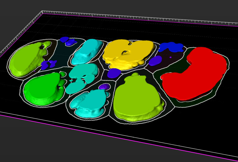 <hr>Reconstruction 3D d’une glande sécrétrice de plante carnivore permettant la visualisation des parois cellulaires et des vacuoles.