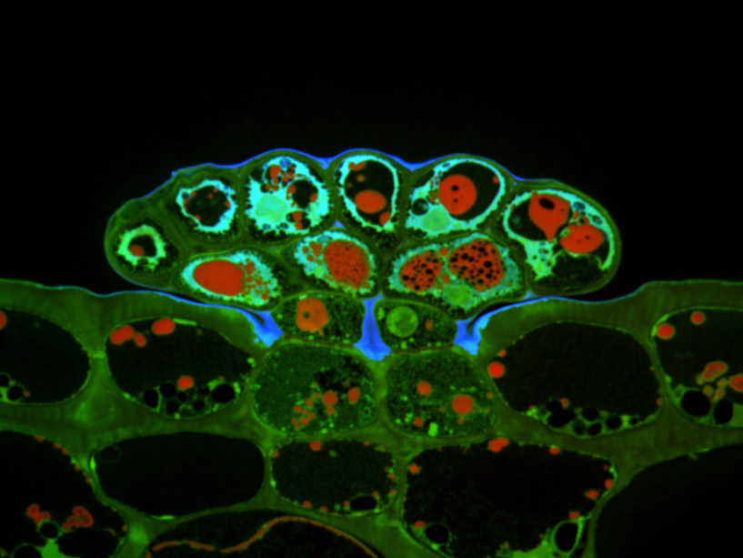 <hr>Cellules sécrétrices des glandes la plante carnivore Dionaea muscipula. Vacuoles en rouge, parois en vert et cytoplasme en bleu.