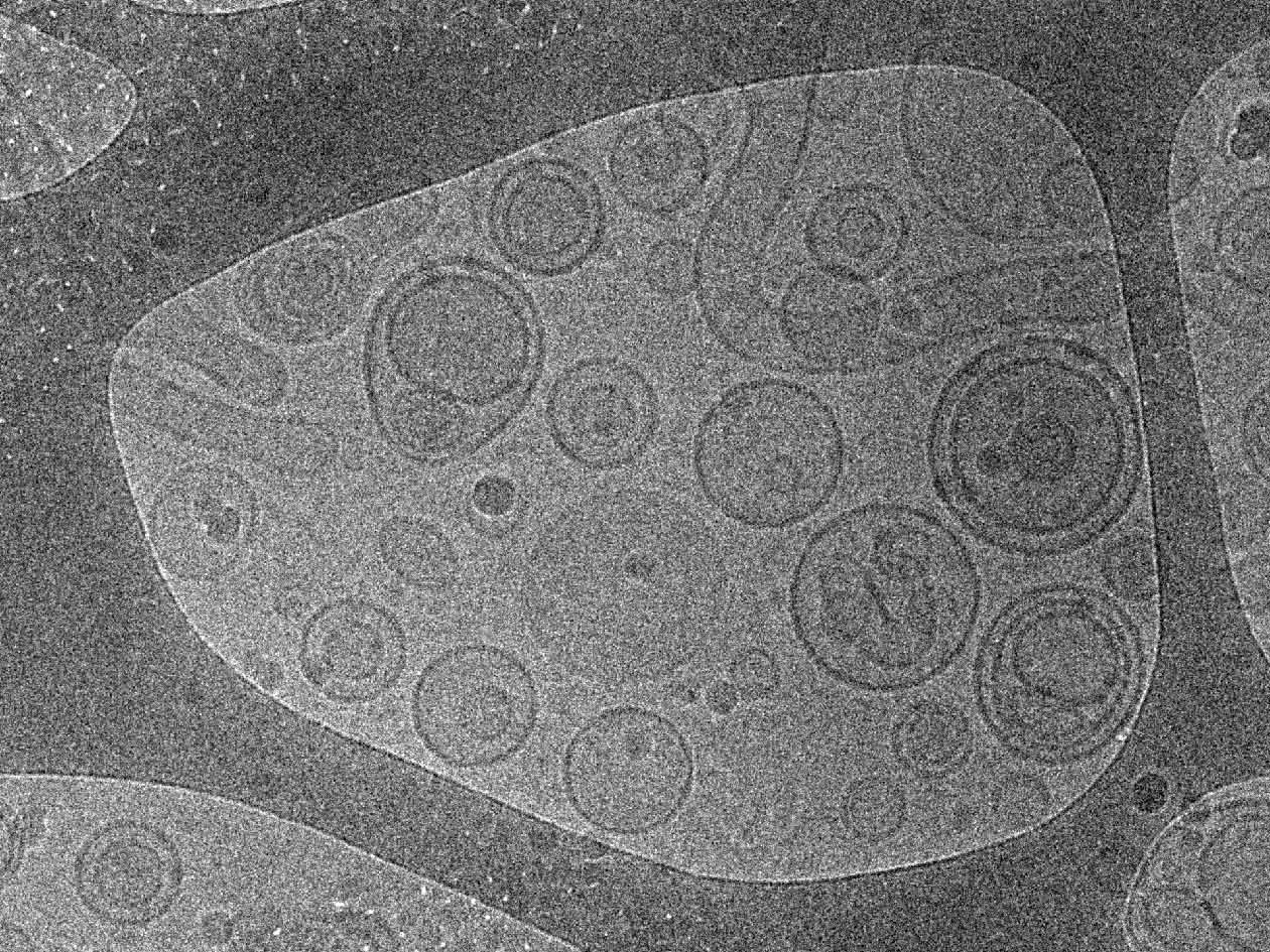 <hr>Liposomes observés en cryo-microscopie électronique.