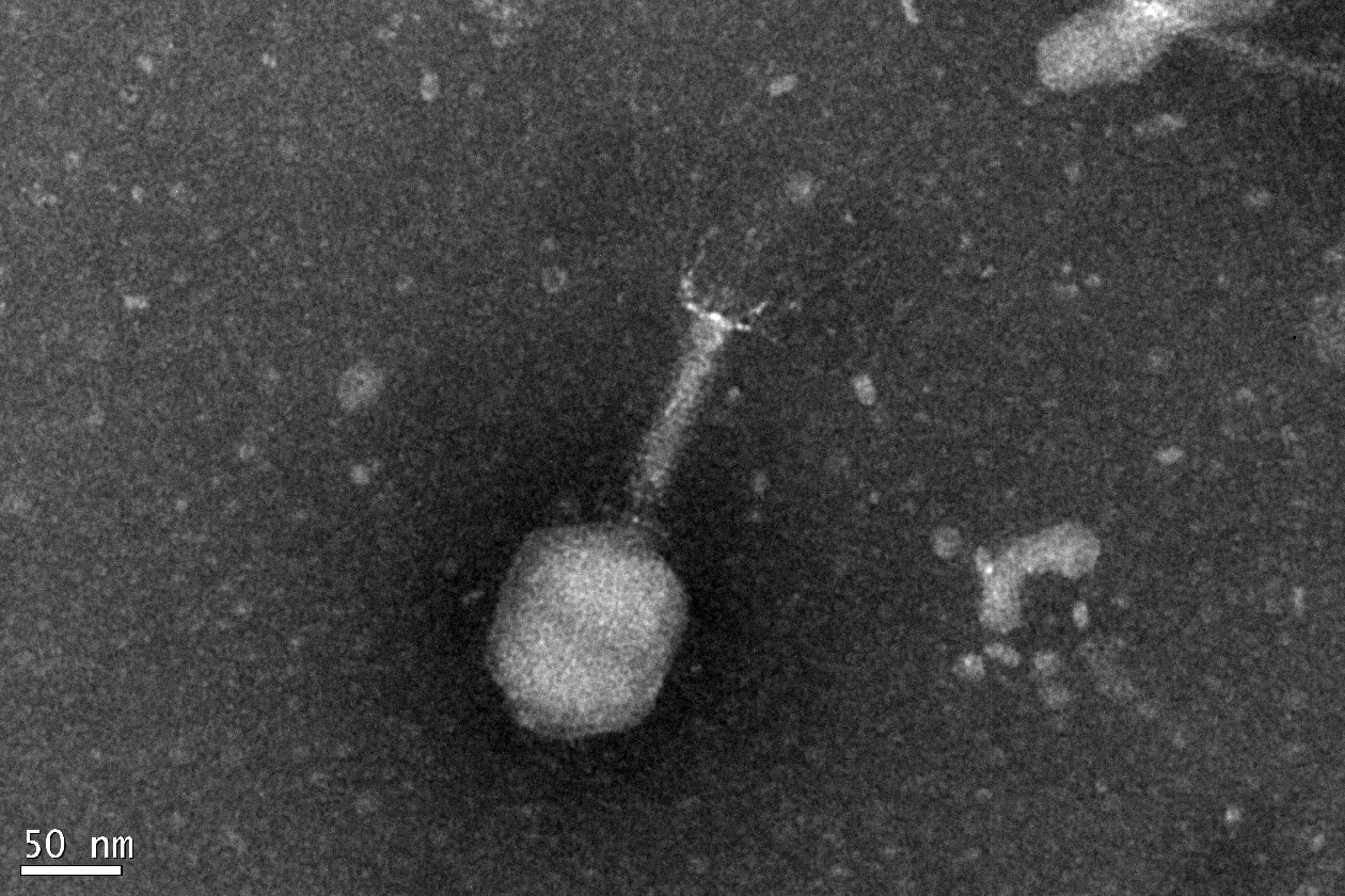 <hr>Bactériophage observé en coloration négative.