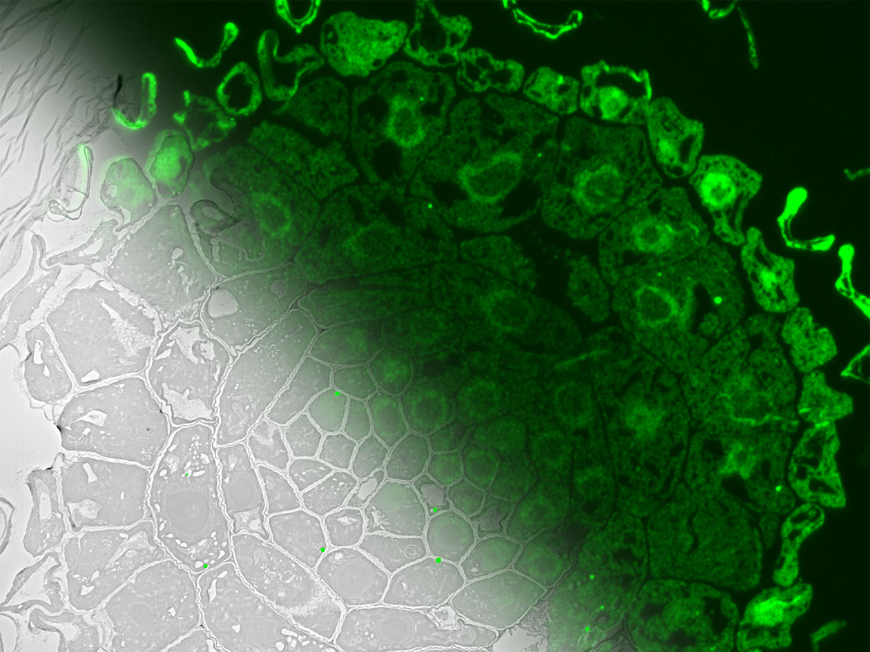 <hr>Coupe de racine d’Arabidopsis thaliana exprimant la protéine ATG8-GFP reconstituée par microscopie corrélative.
