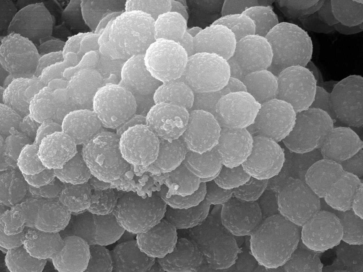 <hr>Biofilm de Staphylococcus aureus observé en MEB.