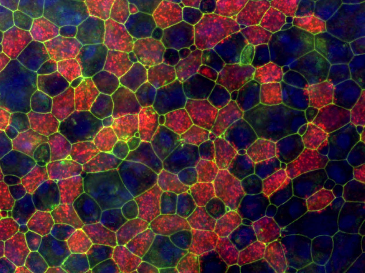 <hr>Triple marquage ZO-1 (en vert), tubuline-b (en rouge) et noyau (en bleu) d’une culture à l’interface air-liquide de cellules respiratoires.